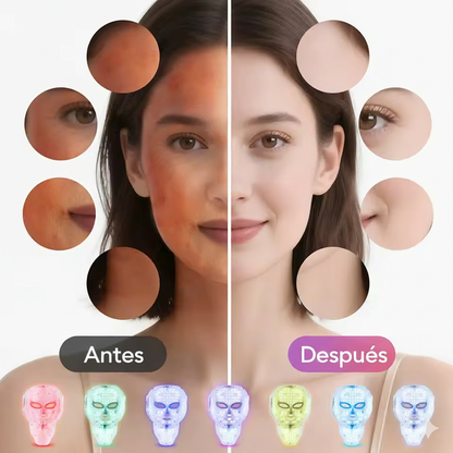 GlowLift™ – Máscara LED Facial & Cervical de Rejuvenecimiento Profundo